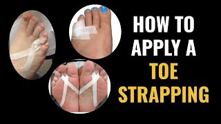 How Do I Do Toe Strapping Dislocated and Fractured Toe [upl. by Anirtik63]