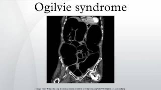 Ogilvie syndrome [upl. by Eilra721]