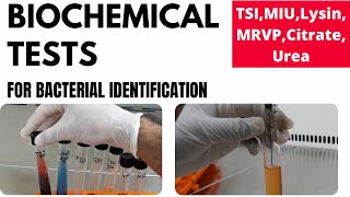 Biochemical Tests for Bacterial Identification Part1TSI MIU MRVP Lysin Urea Citrate [upl. by Anisamoht]