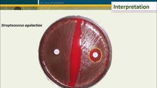 Bacitracin test for Streptococcus pyogenes [upl. by Tirrej]