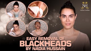 How to Remove Blackheads and Whiteheads [upl. by Aitercul759]