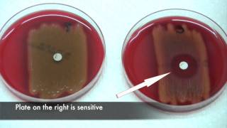 Bacitracin test for Streptococcus pyogenes [upl. by Esmond]