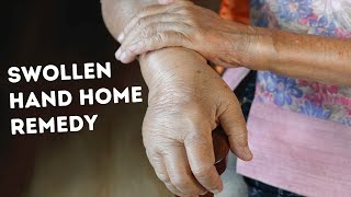 Hand Swelling Home Remedy What to do when Hand Swells [upl. by Marder]