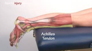 Achilles Tendonitis  Tendinopathy  Explained in 90 Seconds [upl. by Kwon358]