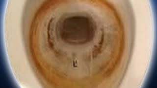 How To Get Rid of Toilet Stains Pt 2  How to Use Muriatic Acid to Clean Toilet Bowl HD [upl. by Tsepmet]