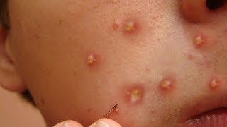 Best Whitehead Pops of All Time [upl. by Legge]